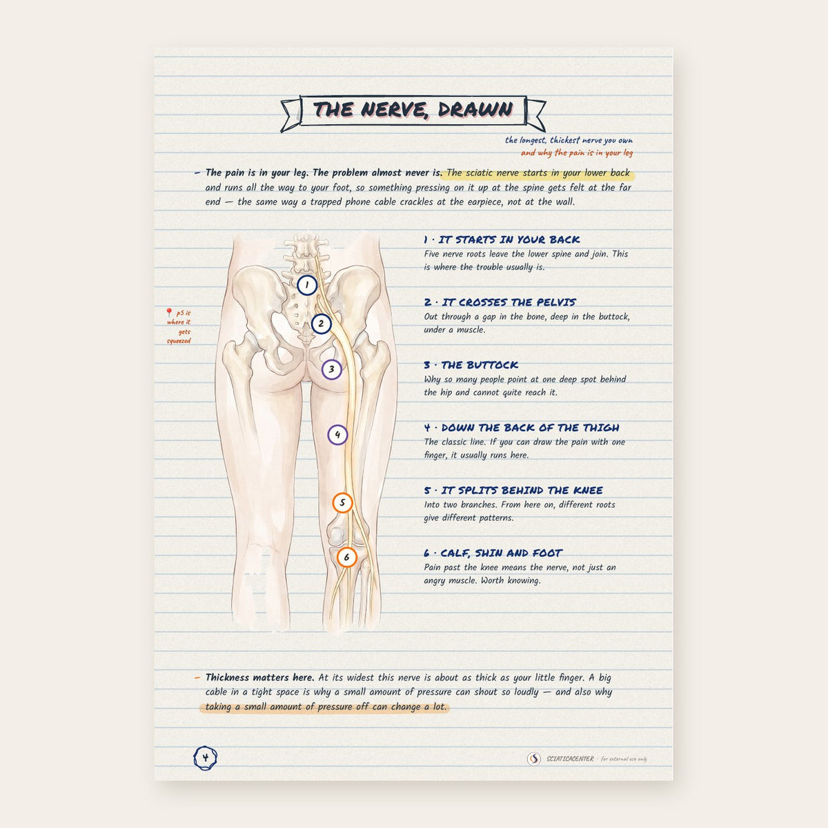 1,000+ Sciatic Notes – The Complete Sciatica Guide [eBook]