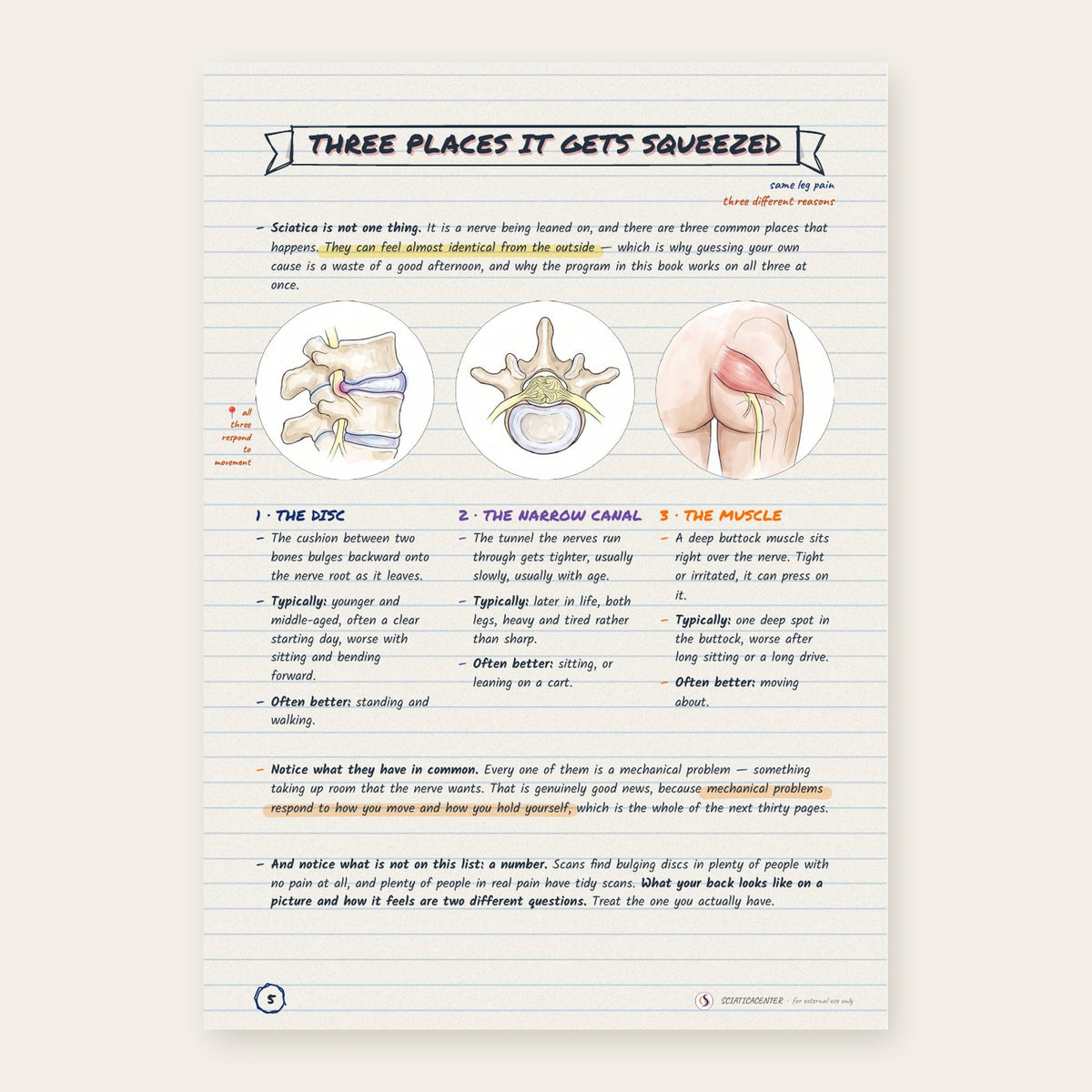 1,000+ Sciatic Notes – The Complete Sciatica Guide [eBook]